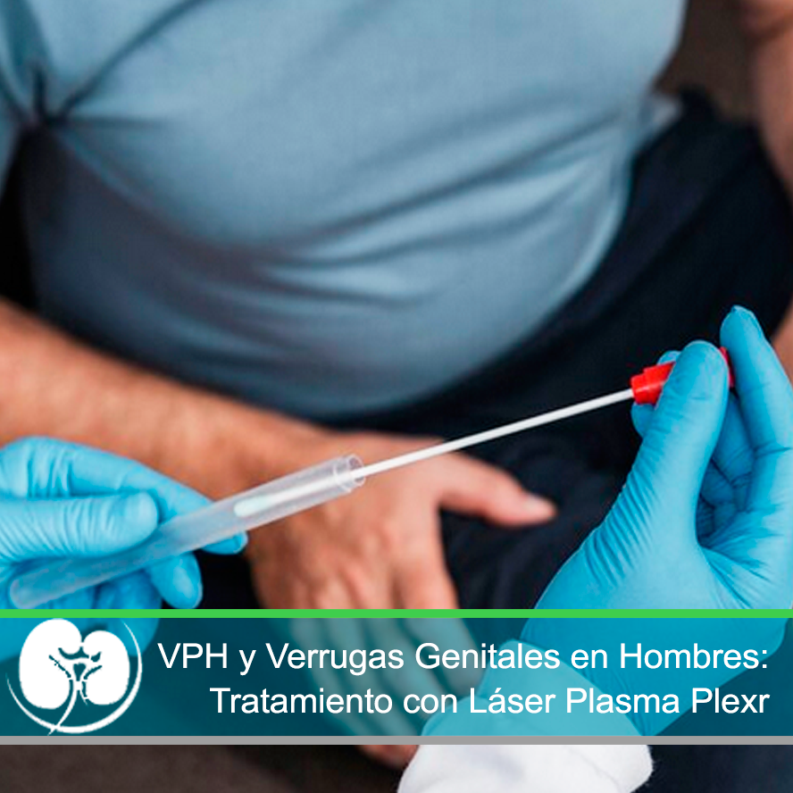 VPH y Verrugas Genitales en Hombres: Tratamiento con Láser Plasma Plexr